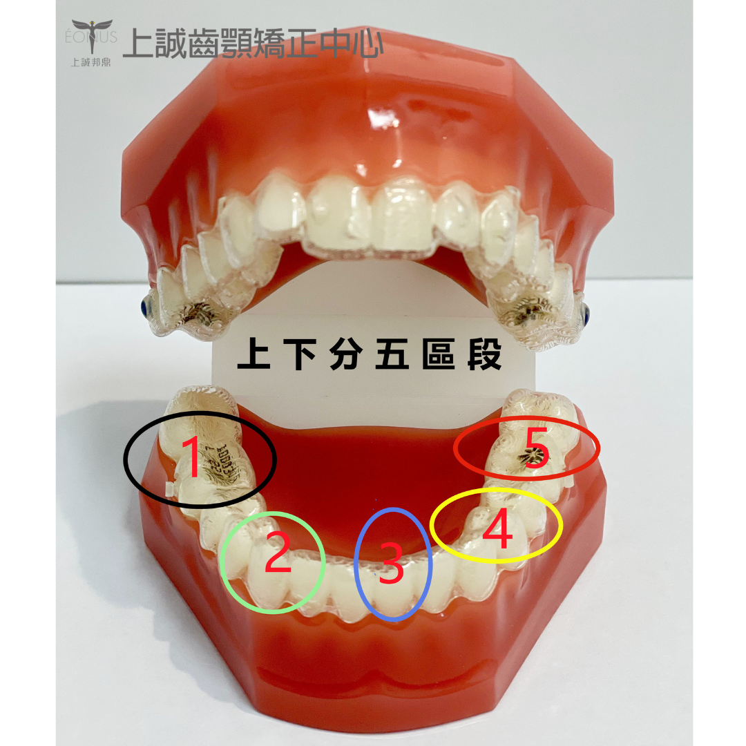 短小柱型(圓形或六角形)